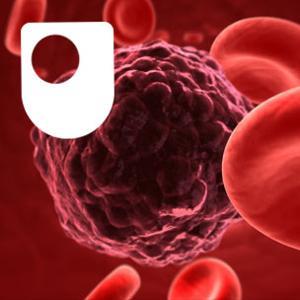 Radiotherapy and its Physics - for iPod/iPhone by The Open University