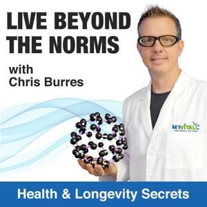 Live Beyond the Norms by Chris Burres
