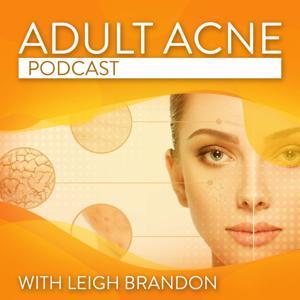 Adult Acne Podcast by Leigh Brandon