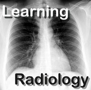 LearningRadiology Video Podcasts by William Herring, MD, FACR